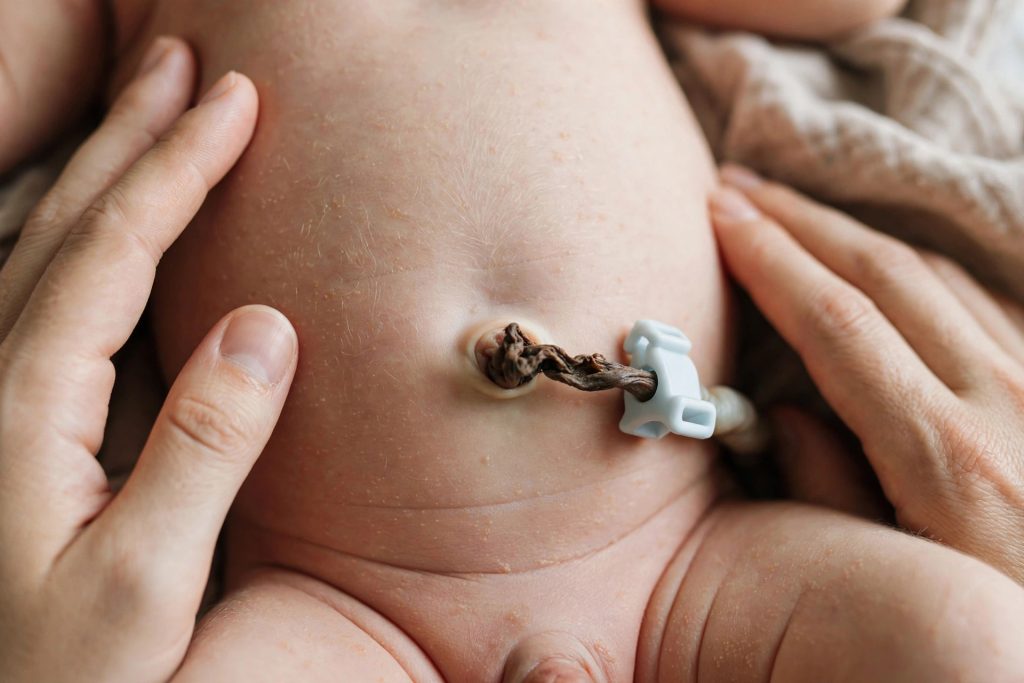 Close-up of a newborn's belly with the umbilical cord stump, a parent's hands gently nearby